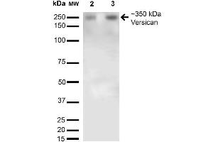 Western Blot analysis of Rat Brain Membrane and brain showing detection of 350kDa Versican protein using Mouse Anti-Versican Monoclonal Antibody, Clone S351-23 . (Versican 抗体  (AA 362-585) (Atto 594))