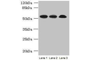 Western blot All lanes: SPERT antibody at 7 μg/mL Lane 1: Rat gonadal tissue Lane 2: Mouse lung tissue Lane 3: A549 whole cell lysate Secondary Goat polyclonal to rabbit IgG at 1/10000 dilution Predicted band size: 52, 48 kDa Observed band size: 52 kDa (SPERT 抗体  (AA 1-412))