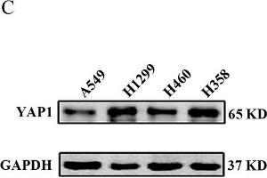 YAP1 expression levels in NSCLC tissues and NSCLC cell lines. (GAPDH 抗体)