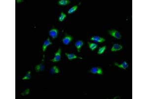Immunofluorescence staining of A549 cells with ABIN7162659 at 1:200, counter-stained with DAPI. (PARD3 抗体  (AA 1068-1356))