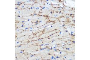 Immunohistochemistry of paraffin-embedded Mouse heart using Connexin 43 Rabbit pAb (ABIN6131701, ABIN6141098, ABIN6141099 and ABIN6215448) at dilution of 1:100 (40x lens). (Connexin 43/GJA1 抗体  (AA 233-382))