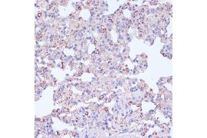 Immunohistochemistry (IHC) image for anti-Integrin beta 2 (ITGB2) (AA 70-170) antibody (ABIN3023118)