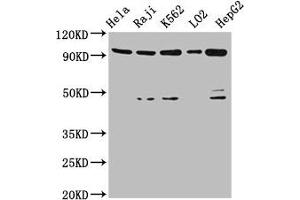 Western Blot Positive WB detected in: Hela whole cell lysate, Raji whole cell lysate, K562 whole cell lysate, LO2 whole cell lysate, HepG2 whole cell lysate All lanes: PROM1 antibody at 4. (CD133 抗体  (AA 508-792))
