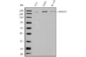 Western blot analysis of RAPGEF2 using anti-RAPGEF2 antibody (ABIN7599891).