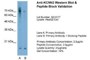 Western Blotting (WB) image for anti-Potassium Intermediate/small Conductance Calcium-Activated Channel, Subfamily N, Member 2 (KCNN2) (C-Term) antibody (ABIN2776144)