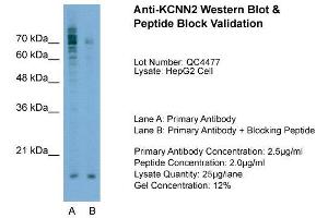 Host:  Rabbit  Target Name:  KCNN2  Sample Type:  HepG2  Lane A:  Primary Antibody  Lane B:  Primary Antibody + Blocking Peptide  Primary Antibody Concentration:  2. (KCNN2 抗体  (C-Term))