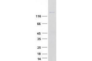 Western Blotting (WB) image for Integrin alpha 11 (ITGA11) protein (Myc-DYKDDDDK Tag) (ABIN2723528)