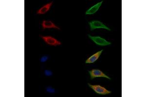 ABIN6262074 and ABIN6272312 staining Hela cells by IF/ICC. (GRAP 抗体  (C-Term))