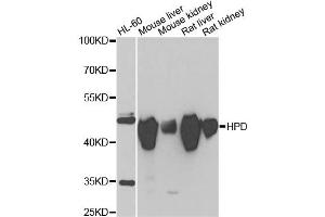 Western blot analysis of extracts of various cell lines, using HPD antibody (ABIN2563239) at 1:1000 dilution. (HPD 抗体)