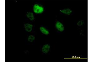Immunofluorescence of monoclonal antibody to SF3B2 on HeLa cell. (SF3B2 抗体  (AA 592-645))