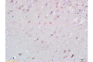Formalin-fixed and paraffin embedded rat brain tissue labeled with Anti-Lingo-1 Polyclonal Antibody, Unconjugated  at 1:200 followed by conjugation to the secondary antibody and DAB staining (LINGO1 抗体  (AA 521-620))