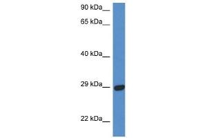 Western Blot showing STX2 antibody used at a concentration of 1 ug/ml against Fetal Heart Lysate (STX2 抗体  (N-Term))