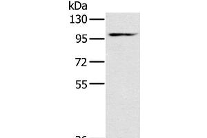 Western Blot analysis of Mouse heart tissue using KCNQ5 Polyclonal Antibody at dilution of 1:500 (KCNQ5 抗体)