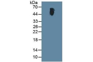 Rabbit Capture antibody from the kit in WB with Positive Control:  Human serum.