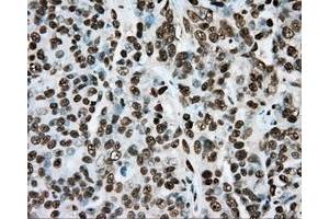 Immunohistochemical staining of paraffin-embedded colon tissue using anti-ARNT mouse monoclonal antibody. (ARNT 抗体)