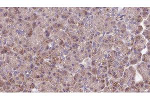 Immunohistochemistry (IHC) image for anti-Optic Atrophy 3 (Autosomal Recessive, with Chorea and Spastic Paraplegia) (OPA3) (Internal Region) antibody (ABIN6263824)