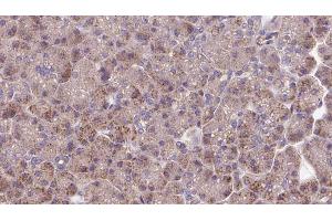 ABIN6273280 at 1/100 staining Human pancreas cancer tissue by IHC-P. (OPA3 抗体  (Internal Region))