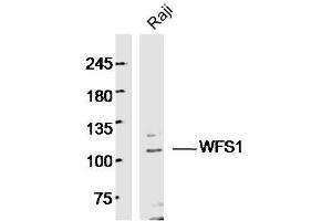Human Raji cells probed with WFS1 Polyclonal Antibody, unconjugated  at 1:300 overnight at 4°C followed by a conjugated secondary antibody at 1:10000 for 90 minutes at 37°C. (WFS1 抗体  (AA 791-890))