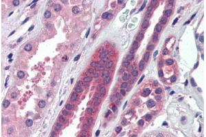 Immunohistochemistry (Paraffin-embedded Sections) (IHC (p)) image for anti-ATPase, H+ Transporting, Lysosomal V0 Subunit A2 (ATP6V0A2) (AA 72-121) antibody (ABIN6741595)