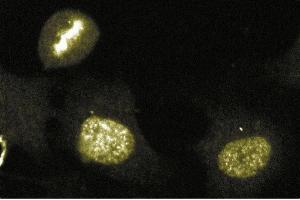 Immunofluorescence staining of human endothelial cells. (Aurora Kinase B 抗体  (AA 2-124))