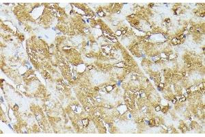 Immunohistochemistry of paraffin-embedded Rat heart using COX15 Polyclonal Antibody at dilution of 1:100 (40x lens). (COX15 抗体)