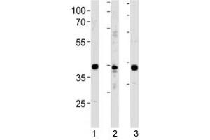 NeuroD1 antibody western blot analysis in 1) Y79 cell line, 2) mouse cerebellum and 3) rat brain tissue lysate. (NEUROD1 抗体  (AA 318-348))
