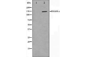 Western blot analysis on 293 cell lysate using PDGFRalpha Antibody,The lane on the left is treated with the antigen-specific peptide. (PDGFRA 抗体  (Internal Region))