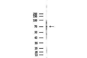 Western blot analysis of lysates from Hela cells(LPS,4h treatment), using ABCF2 Antibody at 1/1000 dilution.