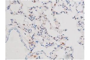 ABIN6267503 at 1/200 staining Rat lung tissue sections by IHC-P. (STAT3 抗体  (pSer727))