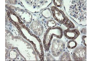 Image no. 8 for anti-Prefoldin Subunit 3 (PFDN3) antibody (ABIN1501702)