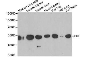 Western blot analysis of extracts of various cell lines, using IHH antibody. (Indian Hedgehog 抗体  (AA 202-411))