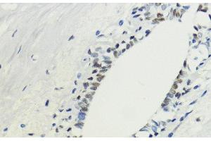 Immunohistochemistry of paraffin-embedded Human breast using TriMethyl-Histone H3-K36 Polyclonal Antibody at dilution of 1:200 (40x lens). (Histone 3 抗体  (3meLys36))