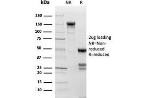 SDS-PAGE Analysis Purified Topoisomerase II alpha, Monoclonal Antibody (TOP2A/1361). (Topoisomerase II alpha 抗体  (AA 1352-1493))