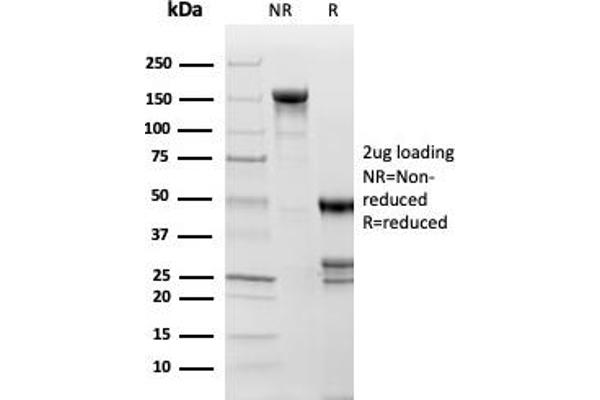 Topoisomerase II alpha antibody  (AA 1352-1493)