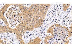Immunohistochemistry (IHC) image for anti-Sequestosome 1 (SQSTM1) (AA 136-400) antibody (ABIN7435412)