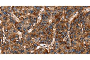Immunohistochemistry (Paraffin-embedded Sections) (IHC (p)) image for anti-Calcium Channel, Voltage-Dependent, beta 2 Subunit (CACNB2) antibody (ABIN7243076)