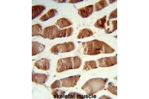 Immunohistochemistry (IHC) image for anti-CSRP2 Binding Protein (CSRP2BP) antibody (ABIN3003941) (CSRP2BP 抗体)