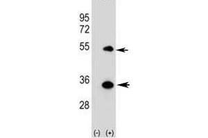 Western blot analysis of ATG5 antibody and 293 cell lysate (2 ug/lane) either nontransfected (Lane 1) or transiently transfected (2) with the human gene. (ATG5 抗体  (AA 1-30))