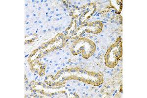 Immunohistochemistry of paraffin-embedded rat kidney using ABL1 antibody at dilution of 1:100 (x40 lens). (ABL1 抗体)