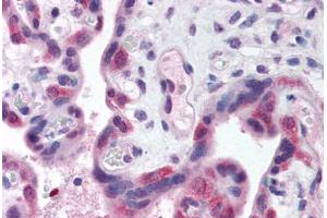 Human Placenta (formalin-fixed, paraffin-embedded) stained with TLR3 antibody ABIN214574 at 5 ug/ml followed by biotinylated goat anti-rabbit IgG secondary antibody ABIN481713, alkaline phosphatase-streptavidin and chromogen. (TLR3 抗体  (N-Term))