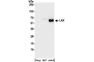 Western Blotting (WB) image for anti-Lymphocyte Transmembrane Adaptor 1 (LAX1) (AA 348-398) antibody (ABIN7450408)