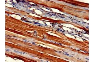 Immunohistochemistry of paraffin-embedded human skeletal muscle tissue using ABIN7152871 at dilution of 1:100 (Fibromodulin 抗体  (AA 18-89))