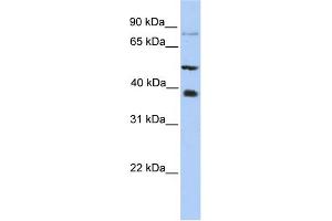 WB Suggested Anti-METTL2B Antibody Titration:  0. (METTL2B 抗体  (N-Term))