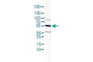 Western Blot (Cell lysate) analysis of U-138 cell lysate. (IL1R1 抗体)
