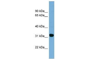WB Suggested Anti-CBR1  Antibody Titration: 0. (CBR1 抗体  (Middle Region))