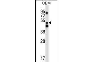 XPNPEP3 Antibody (C-term) (ABIN657127 and ABIN2846271) western blot analysis in CEM cell line lysates (35 μg/lane).