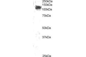 ABIN184673 staining (2µg/ml) of 3T3 lysate (RIPA buffer, 35µg total protein per lane). (CBL 抗体  (C-Term))