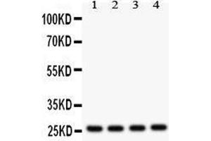 Western Blotting (WB) image for anti-Fms-Related tyrosine Kinase 3 Ligand (FLT3LG) (AA 79-110), (N-Term) antibody (ABIN3042394) (FLT3LG 抗体  (N-Term))