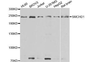 Western blot analysis of extracts of various cell lines, using SMCHD1 antibody (ABIN5974343) at 1/1000 dilution. (SMCHD1 抗体)