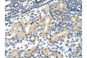 MLXIPL antibody was used for immunohistochemistry at a concentration of 4-8 ug/ml to stain Epithelial cells of renal tubule (arrows) in Human Kidney.
